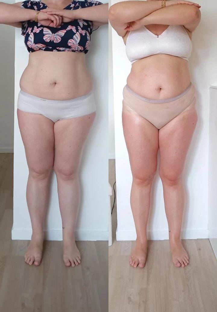 Résultat avant après soin Dianita Massages